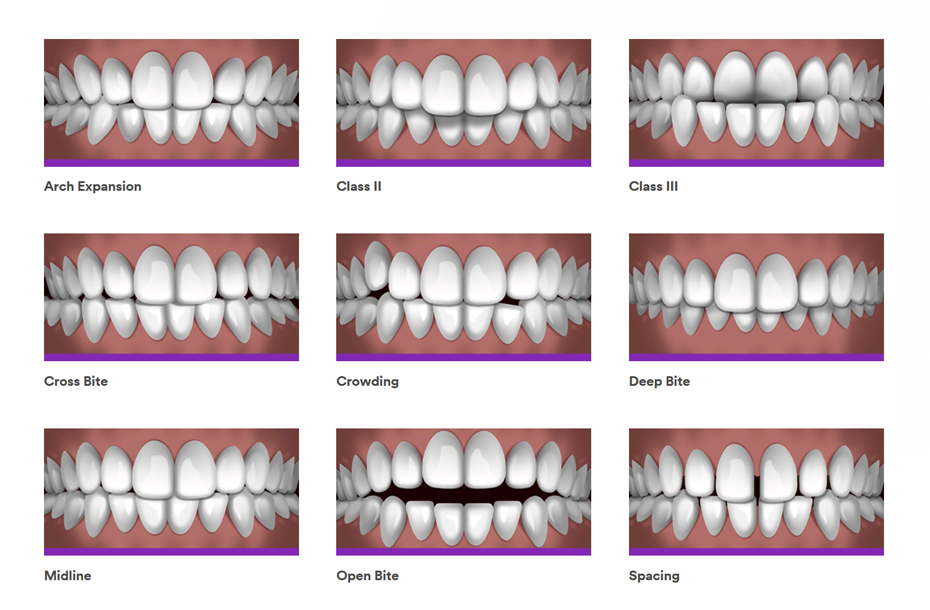 Reston Orthodontics